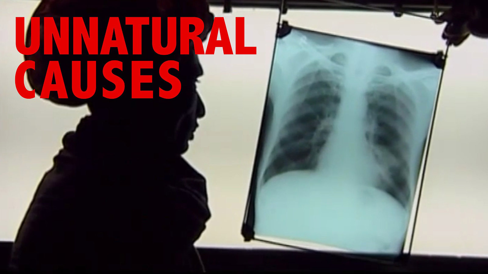 Unnatural Causes