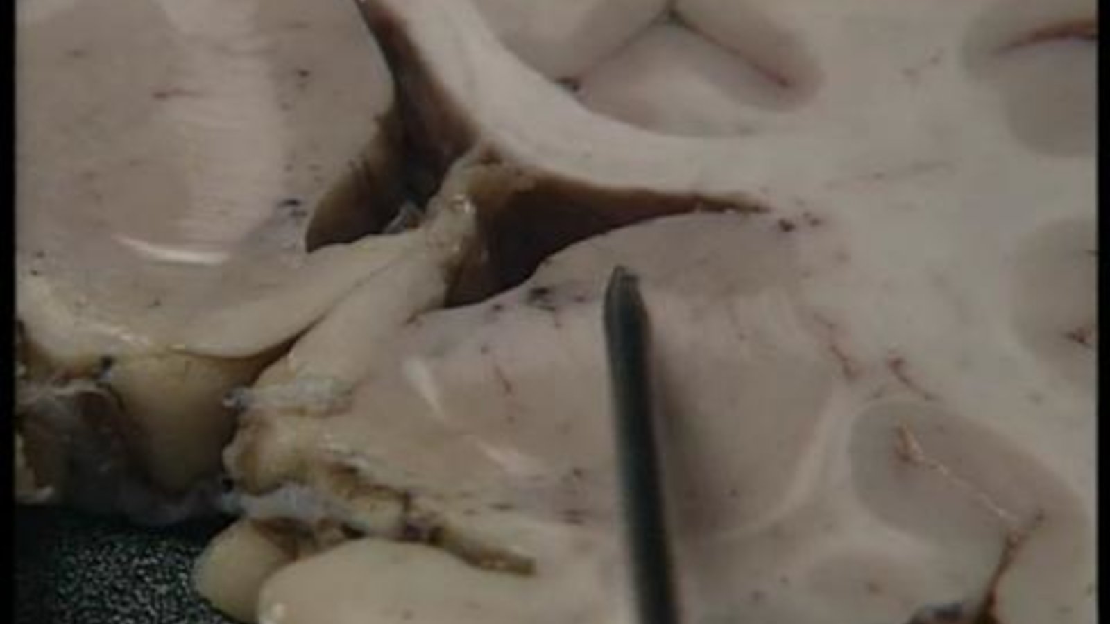 The Human Brain: Anatomy