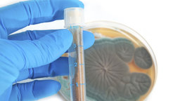1928—The Discovery of Penicillin