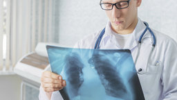 Malaria and Tuberculosis: Global Killers